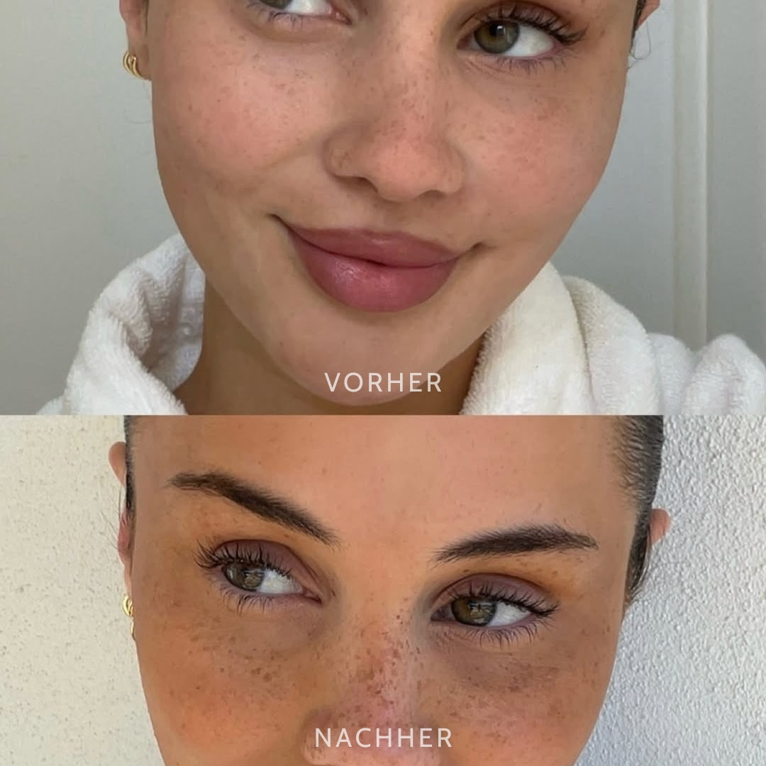 SonnenPunkte™ Verspielter Beauty-Akzent