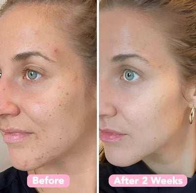 2+2 Gratis | GlanzPads™ Sanfter Strahlender Glanz